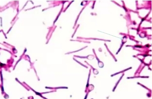 <p>Identify the endospore. </p>