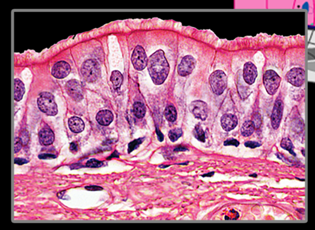 <p>pseudostratified columnar epithelium</p>