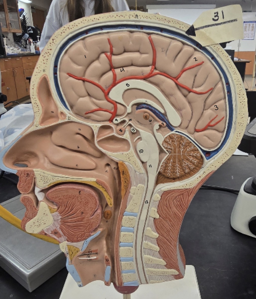 <p>Name Region/Part of Brain, Be Specific (#6)</p>