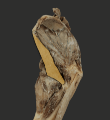 <p>What muscle is highlighted in the picture?</p>