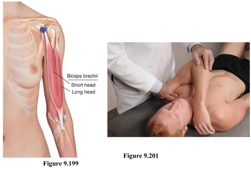 <p>F Add IR</p><p>Location is at the inferolateral aspect of the coracoid process</p><ol><li><p>Pt supine</p></li><li><p>Physician can stand from either side</p></li><li><p>Start at AC joint and follow down until you feel a bony prominence (will need to move through muscle). Then go inferior and lateral of coracoid process to locate point.</p></li><li><p>Tip - feel for humeral head and point will be slightly medial to that. Or just cup and thumb should feel it.</p></li><li><p>Shoulder stays on table!!!!</p></li><li><p>elbow and shoulder are flexed, shoulder minimally adducted and internally rotate (same side arm crosses to grab onto opposite shoulder)</p></li></ol><p></p>