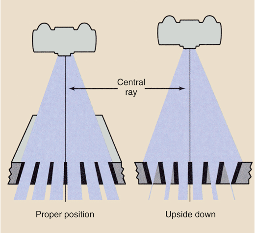 <ul><li><p>Occurs when a focused grid is placed upside down on the IR, resulting in the grid lines going opposite the angle of divergence of the x-ray beam</p></li><li><p>Causes the lateral edges of the IR to be highly under exposed</p><ul><li><p>Is easily avoided because every focused grid should have a label indicating “tube side”</p></li><li><p>This side of the grid should always face the tube, away from the IR</p></li></ul></li></ul><p></p>