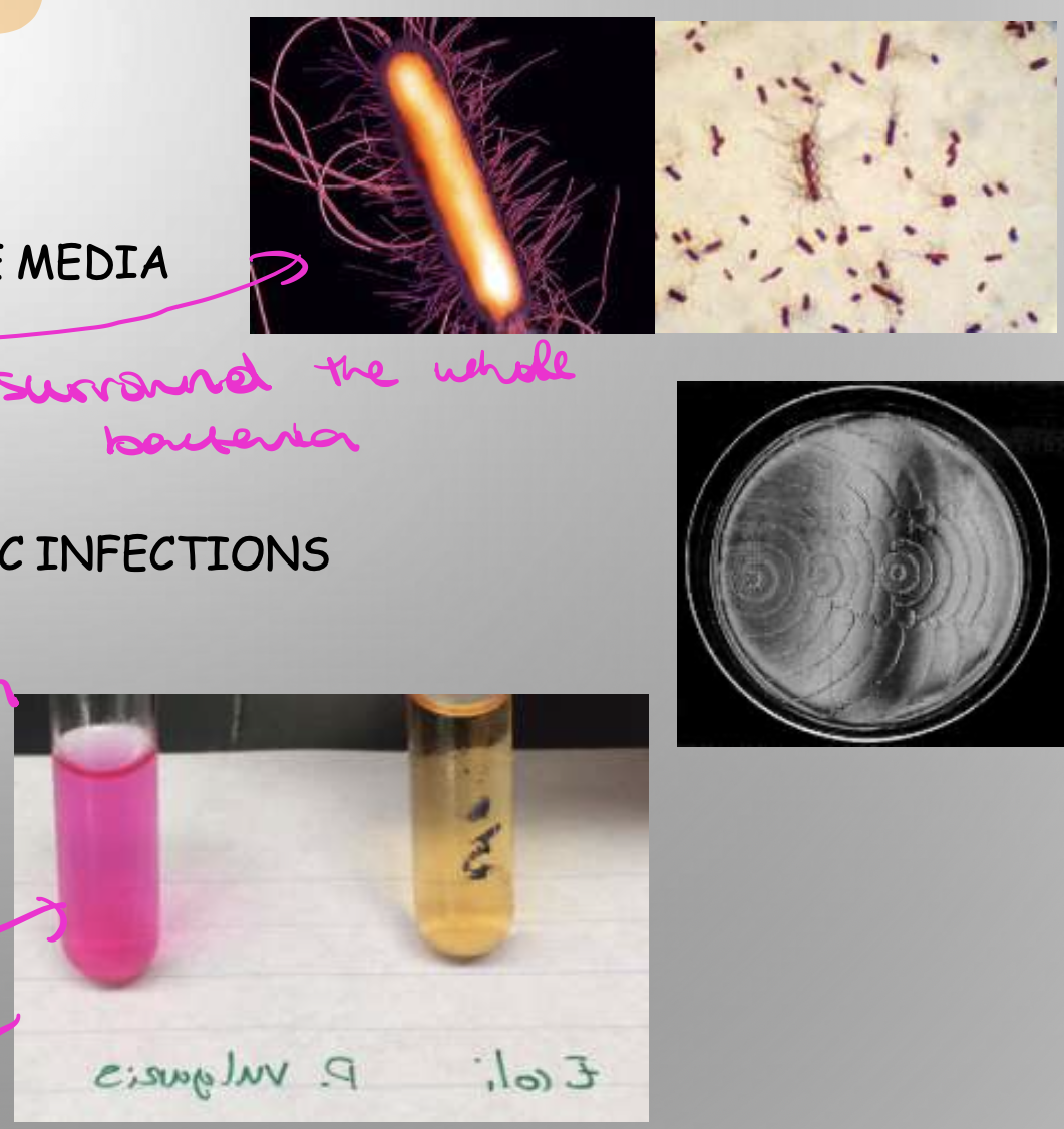 <p>UTIs with alkalinity → which causes precipitation into kidney stones</p><p>PERITRICHOUS FLAGELLA and Urease positive (turns urea into ammonia)</p><p></p><p>propagate stones </p>
