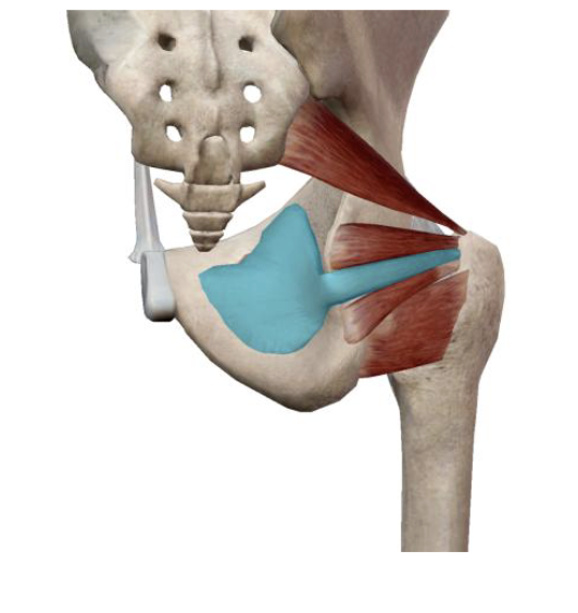 <p>What is the name, origin, and insertion of this muscle?</p>