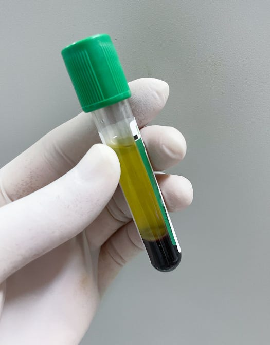 <p><span style="color: rgb(84, 173, 84);"><strong>Green (Sodium Heparin)</strong></span></p>