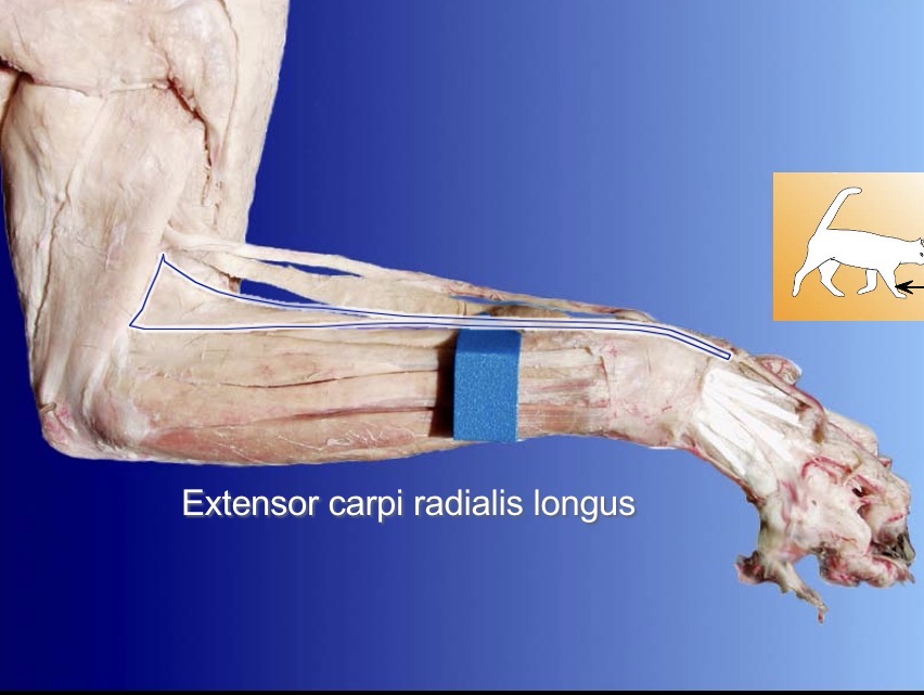 <p>extensor carpi radialis longus</p><p>action: extends wrist</p><p>s: extensor carpi radialis brevis</p><p>a: flexor carpi radialis</p>