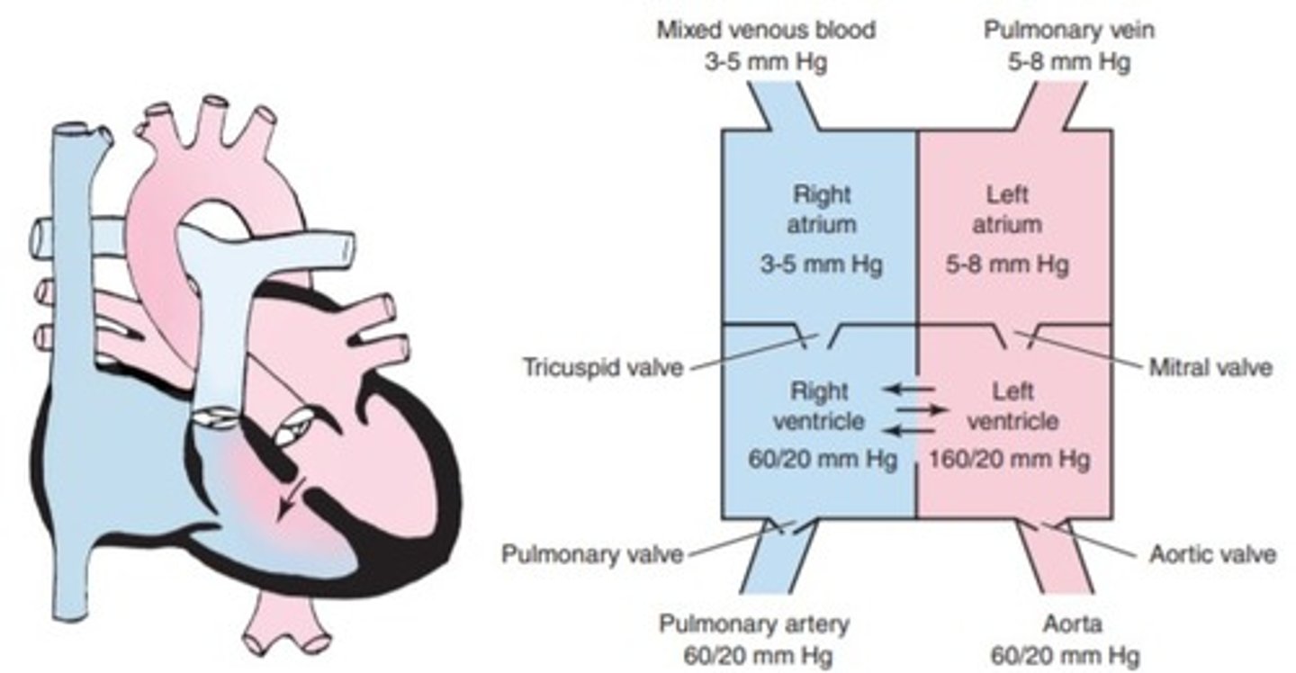 <p>a. truncus arteriosus</p><p>b. hypoplastic left ventricle</p><p>c. transposition of the great vessels</p><p>d. ventricular septal defect</p>