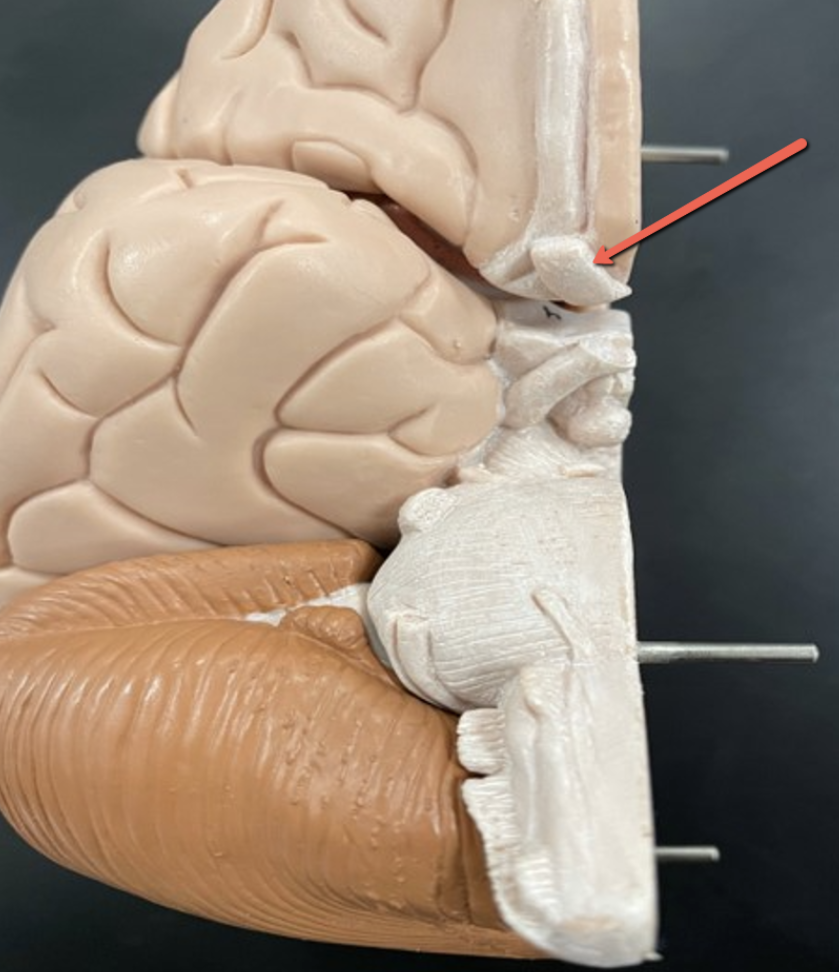 <p><span><strong>Identify the cranial nerve indicated by the pointer.</strong></span></p>