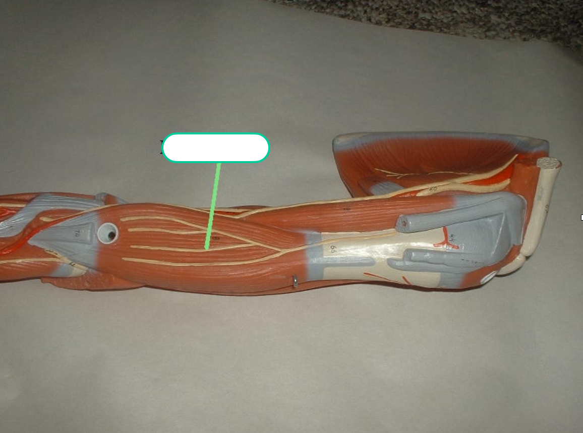 <p>(without bicep on top of it)</p>