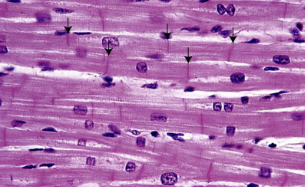 <p>Are there striations (stripes) for <u>Cardiac muscle</u>?</p>