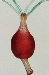 <p>what genus and stage is this</p>