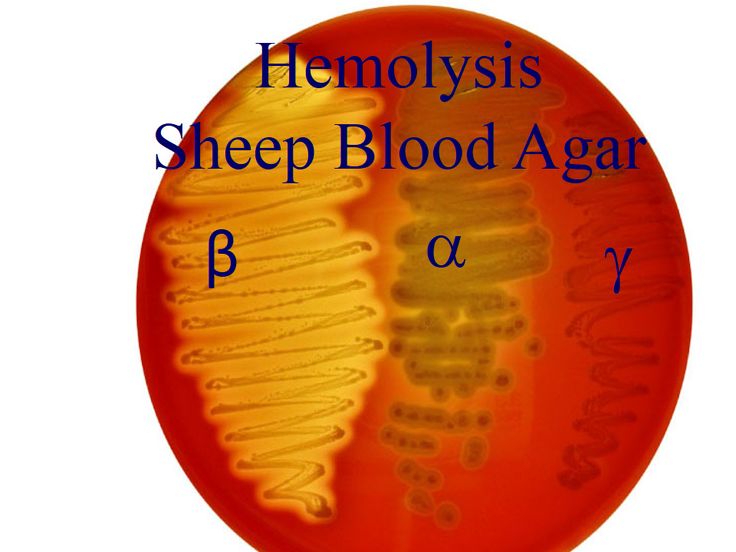 <p>Fill in the blanks:</p><ol><li><p>Alpha hemolysis is a _____ lysis and is ____ around the colony</p></li><li><p>Beta hemolysis is a _______ lysis and is ____ around the colony</p></li><li><p>Gamma (No hemolysis) has no/yes change in medium</p></li></ol><p></p>
