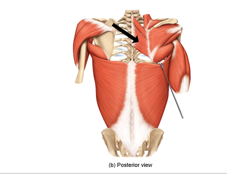 <p>What muscle is being pointed to? what is its action?</p>