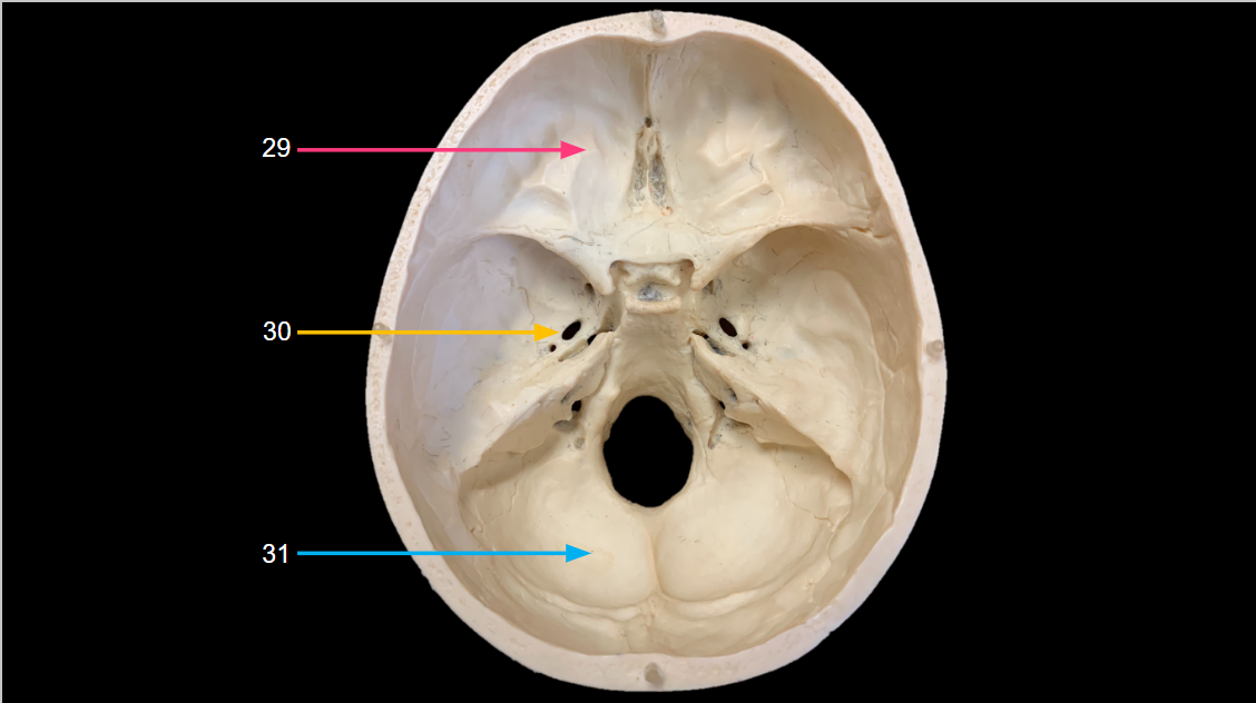 <p>WHAT IS 29 CALLED?</p>