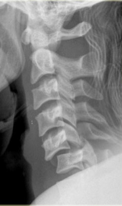 <p>What is the diagnosis?</p>