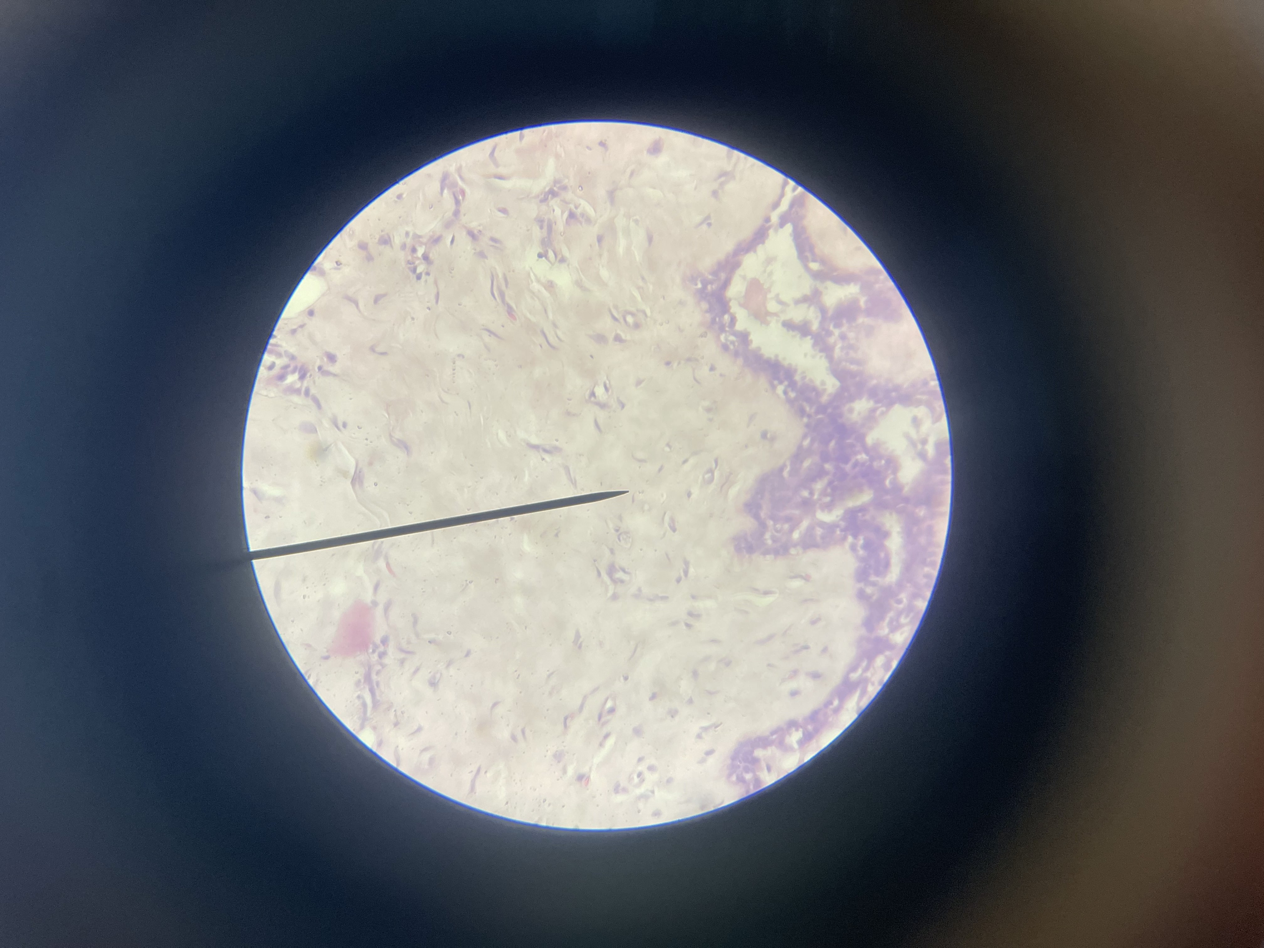 <p>What is the diagnosis?</p>