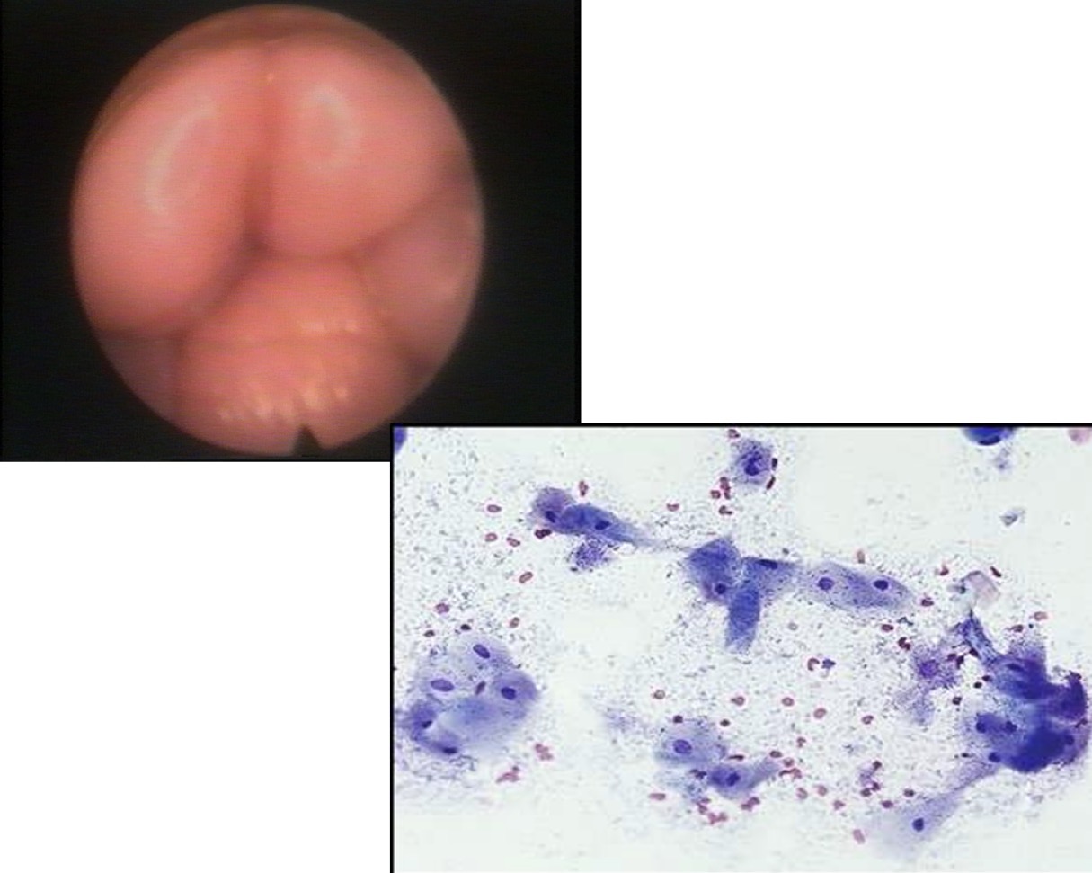 <p>A 3yo Golden Retriever female dog is presented for breeding with chilled semen. The owner reports that the female dog came into heat yesterday. The vaginoscopy + vaginal cytology results are as shown in the pictures. What stage of the estrous cycle is she most likely in?</p>