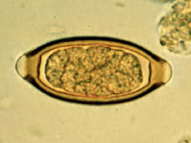 <p>trichuris trichiura</p>