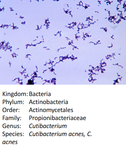 <ul><li><p>slow-growing</p></li><li><p>typically aerotolerant anaerobic</p></li><li><p>Gram Positive</p></li><li><p>rod shaped</p></li><li><p>part of normal skin flora also found deep in hair follicles and pores → can cause acne</p></li><li><p>use sebum, cellular debris, and metabolic byproducts form surrounding skin tissue as primary sources of energy and nutrients</p></li></ul><p></p>