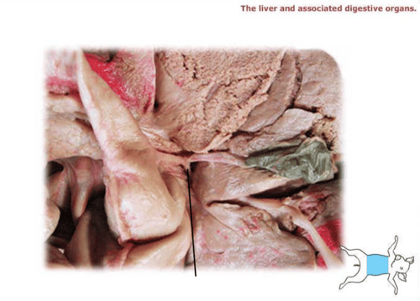<p>The duct that leads from the liver to the common bile duct; transports bile.</p>