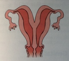 <p>two separate uterine bodies</p>