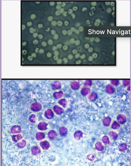 <p>What Protozoan is this?</p>