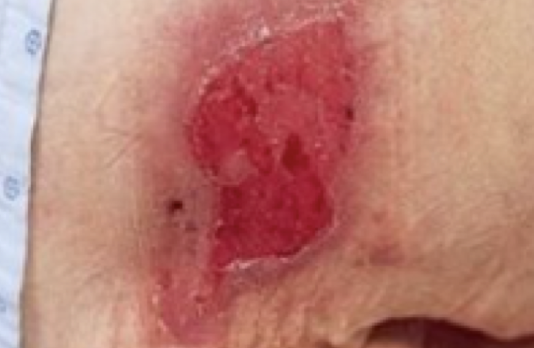 <p>Pink, red, viable, and moist.</p>