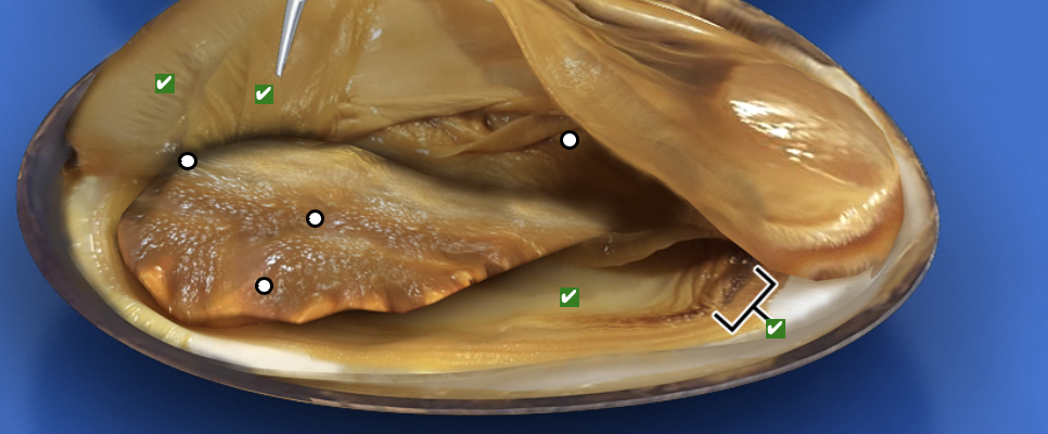 <p>What structure is this pointing to?</p>