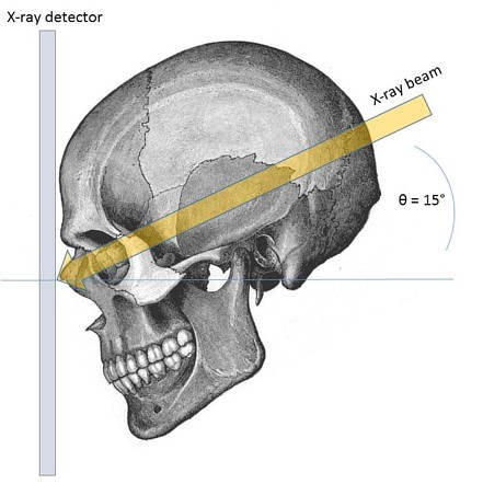 term image