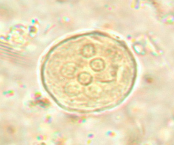 <p>Name</p>