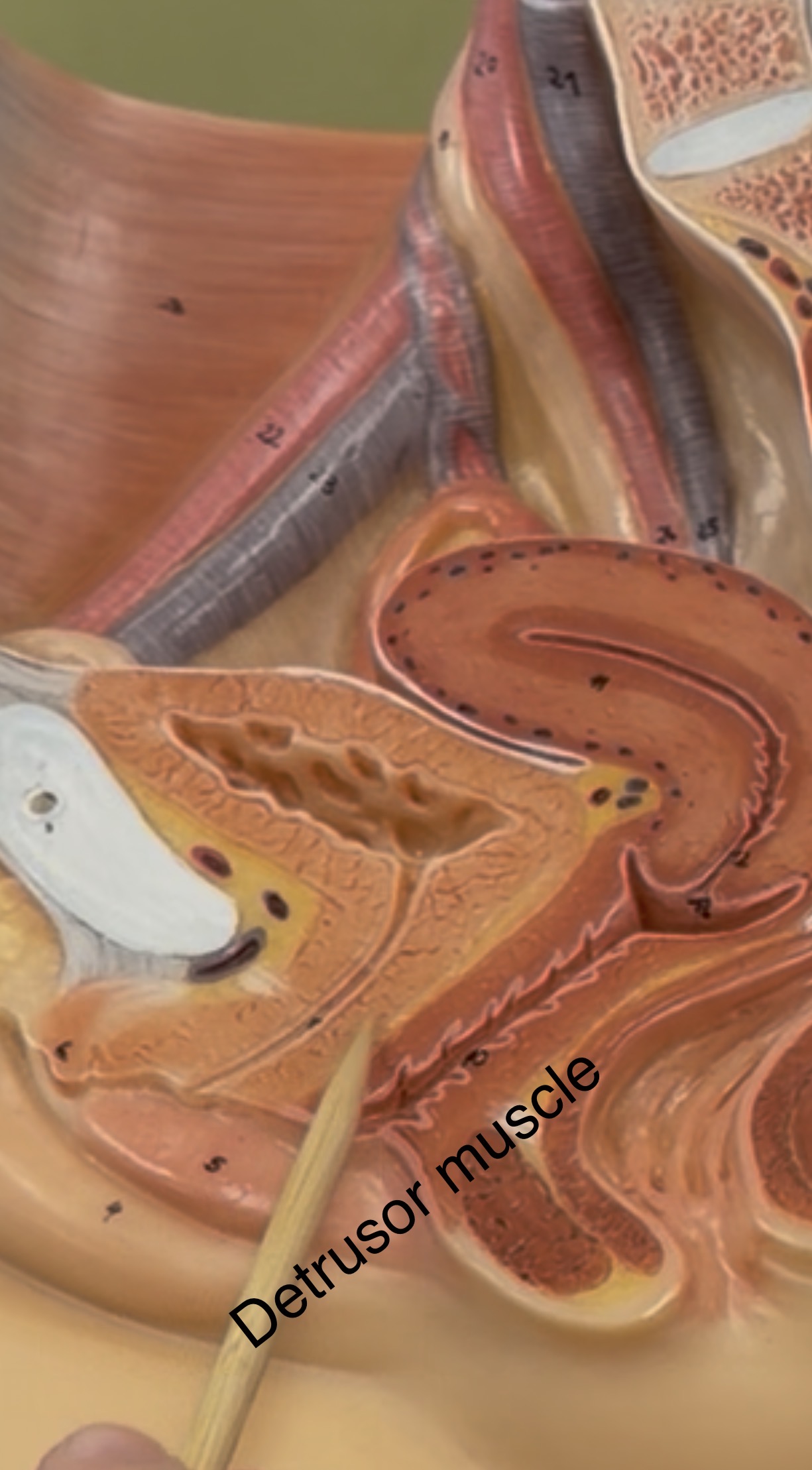 <p>Detrusor muscle</p>