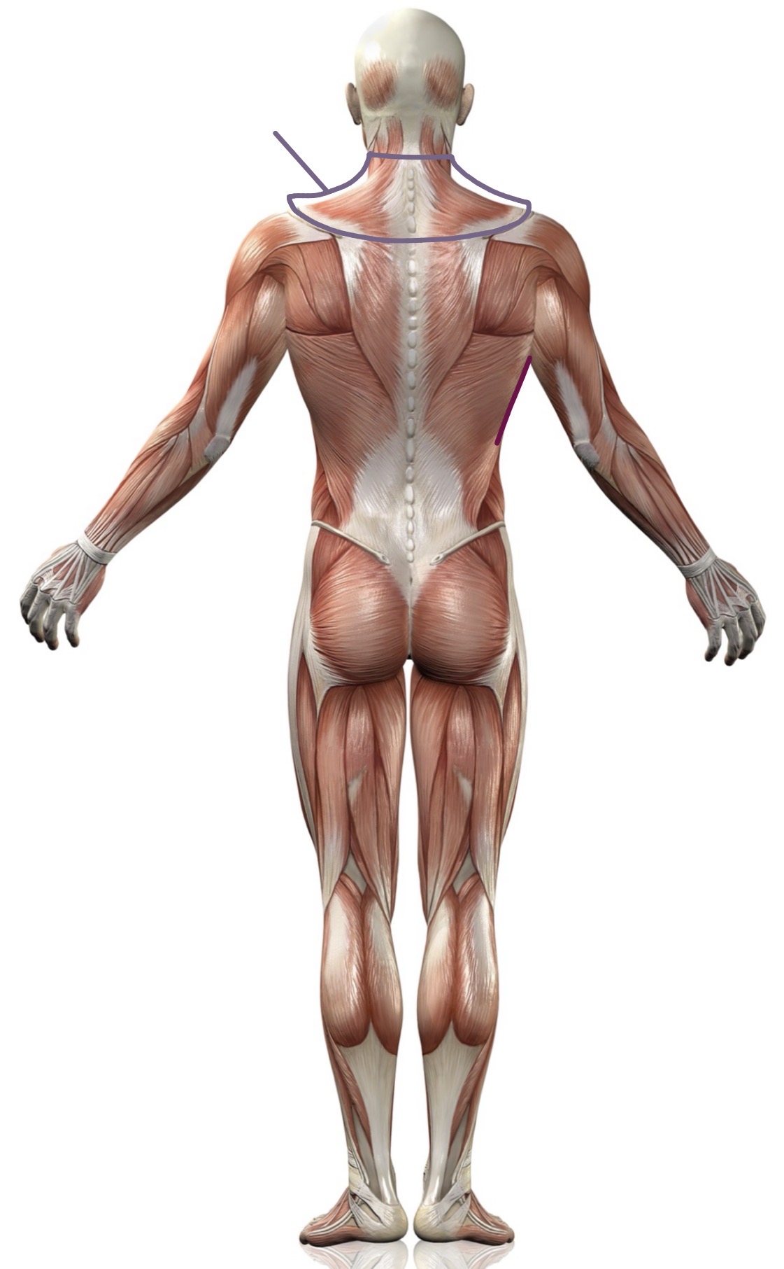 <p><strong>Name the following muscle</strong></p>