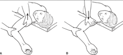 <p>tests for anterior glenohumeral instability</p>