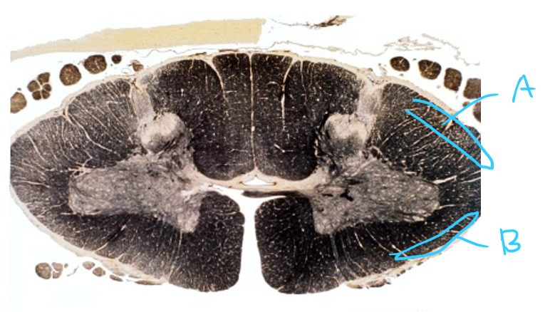 <p>Consider A and B. Describe the path of the neurons.</p>
