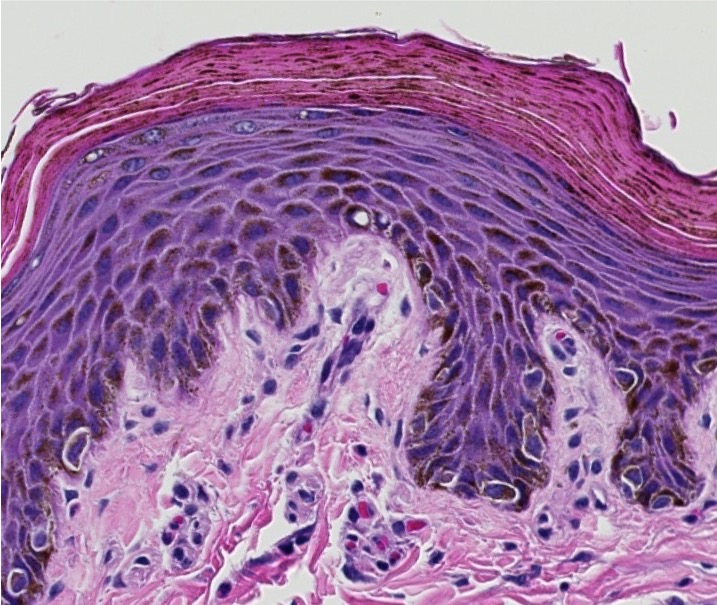 <p><span style="font-family: "Calibri Light";">ID the type of epithelium lining the surface of this tissue.</span></p>