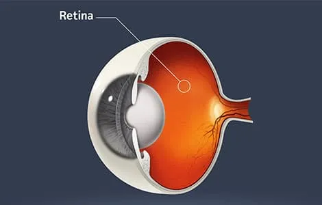 <p>whats the inner orange membrane</p>