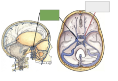 <p>This is the</p>