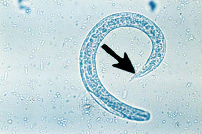 <p>Identify the parasite and its characteristics:</p>