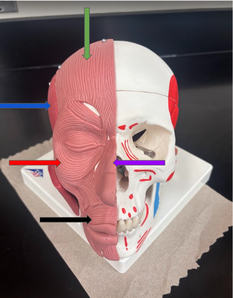 <p>What muscle is the red arrow pointing to?</p>