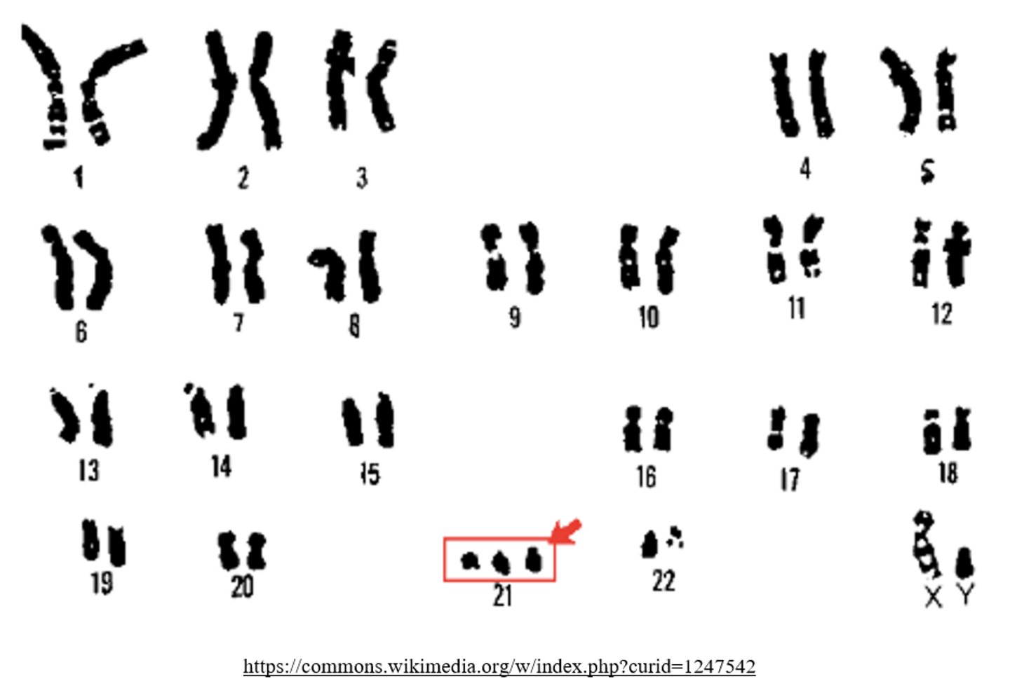 <p>trisomy</p><p>(ex: trisomy 21 = Downs syndrome)</p>