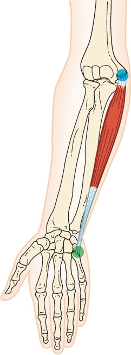 <p>O: Medial epicondyle of the humerus</p><p>I: Pisiform and base of the 5 metacarpal</p><p>A: Wrist flexion, ulnar deviation</p><p>N: Ulnar nerve</p>