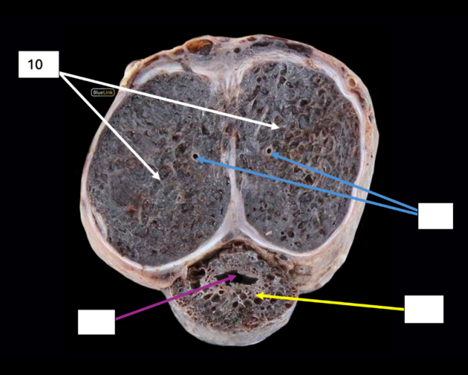 <p>Identify</p><p>Side Question:</p><p>Each of these is surrounded by which structure?</p><p>This continues posteriorly to become which structure and is covered by which muscle?</p><p>Together with corpus spongiosum ventrally, this is enclosed by which structure?</p>