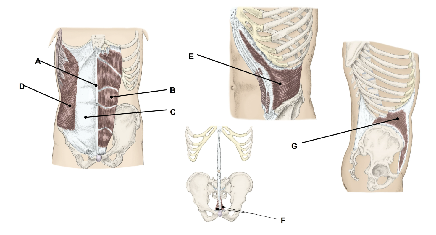 <p><span>Match the appropriate term with the landmark or structure (A-G) identified in the picture below. Answers are used once and there are incorrect choices. NO partial credit.</span></p>