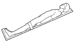 <p>supine position with the head tilted higher is</p>