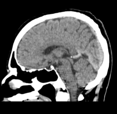 <p>Type of scan, orientation </p>