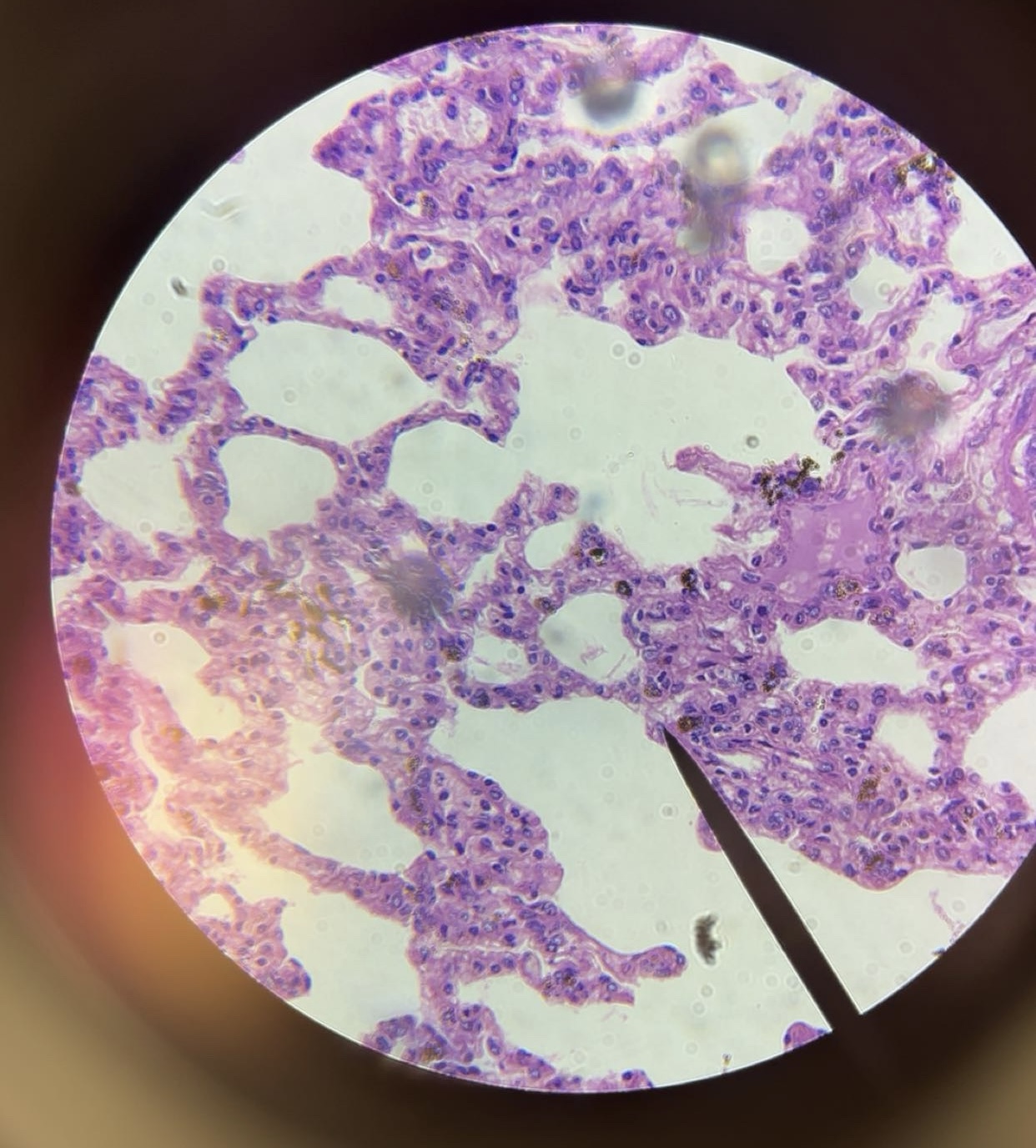 <p>Tissue</p>