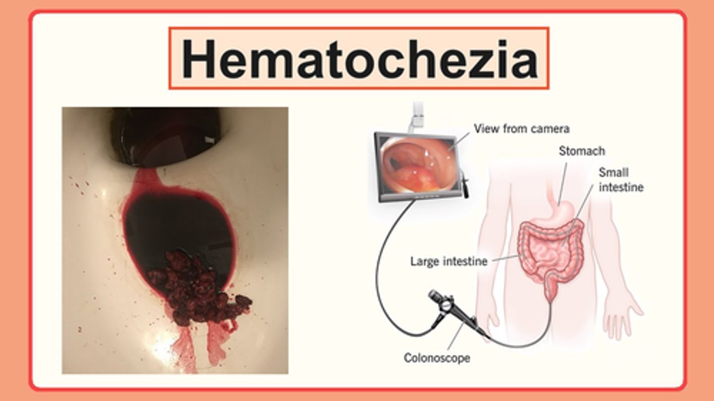 <p>B) Blood in the stool</p>