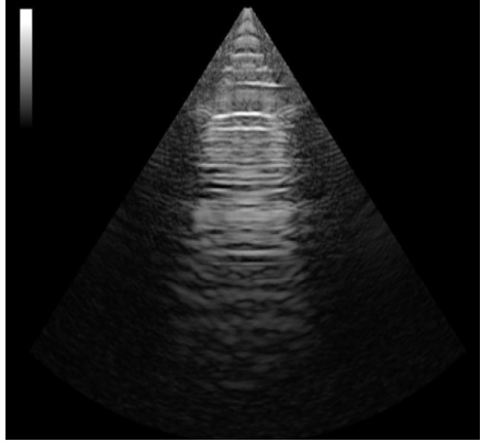 <p>What type of transducer produced the image?</p>