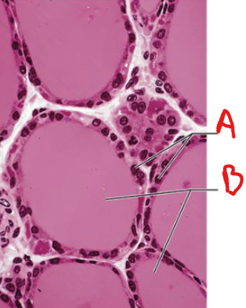<p>What organ is this a slice of?</p>