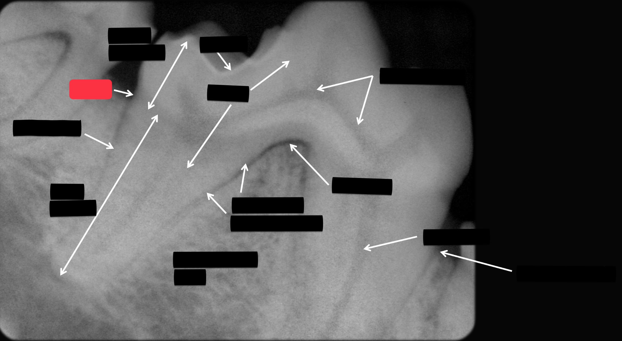 <p>Label this part of the tooth.</p>